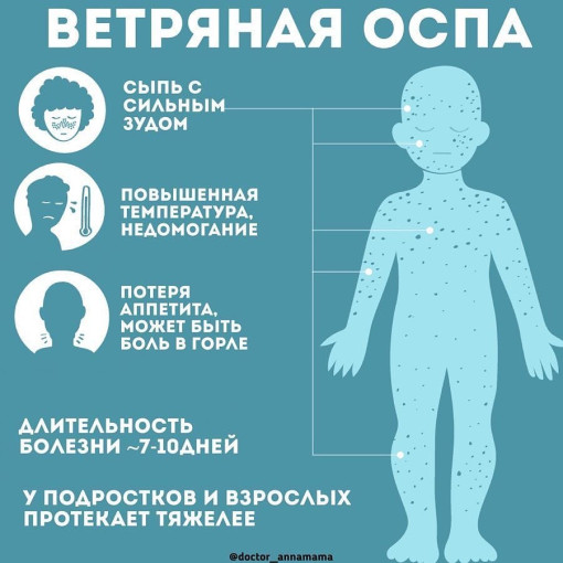 Профилактика ветряной оспы Профилактика ветряной оспы.